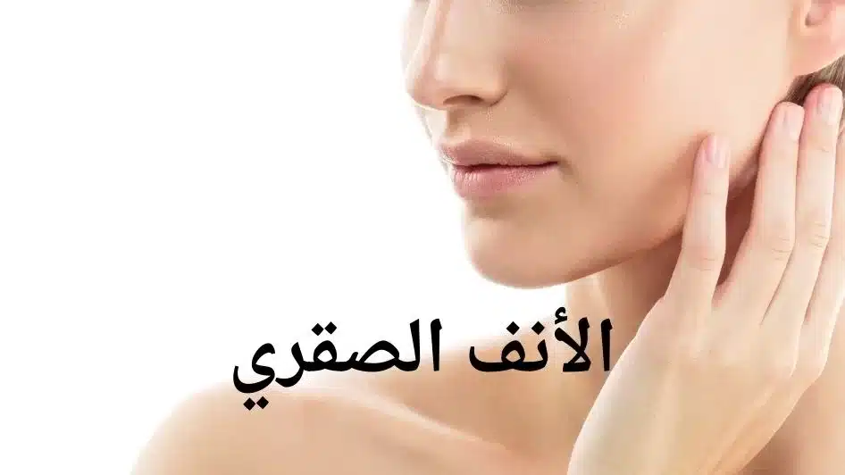 أنف الصقر