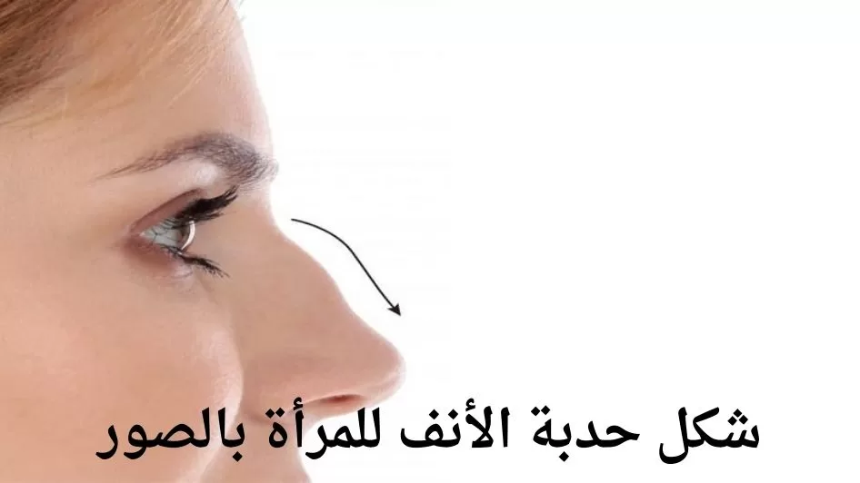 شكل سنام الأنف للنساء بالصور